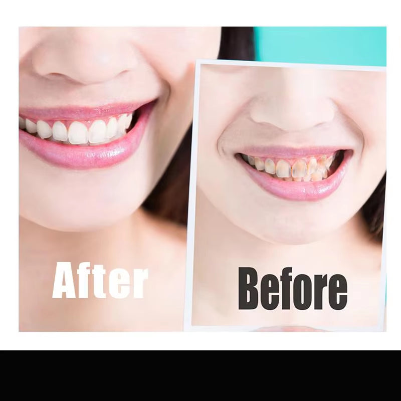 14Pcs/Box Teeth Whitening Strip Charcoal Teeth Whitening Strips Remove Coffee Tea Stains Tooth Whitening Kit Dental Bleaching